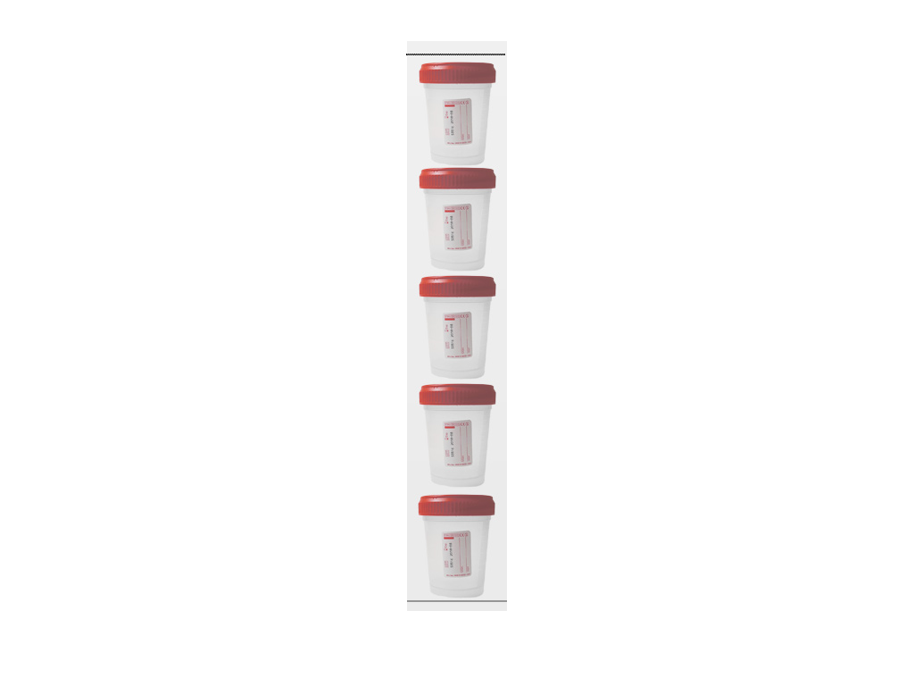 Container PP 125 ml met rode dop, per 5 stuks steriel (400 stuks)
